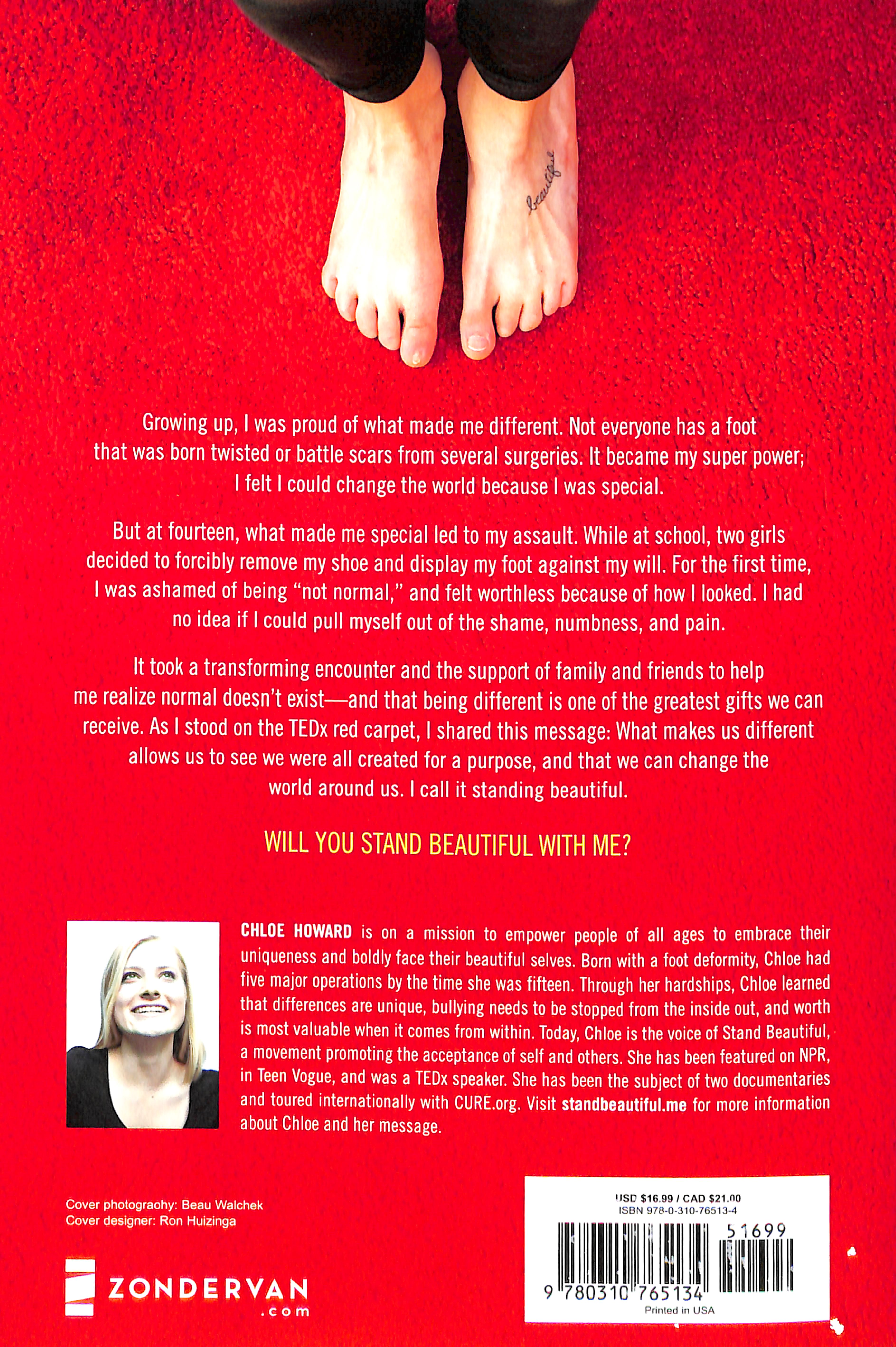 Stand Beautiful: A Story of Brokenness, Beauty and Embracing It All