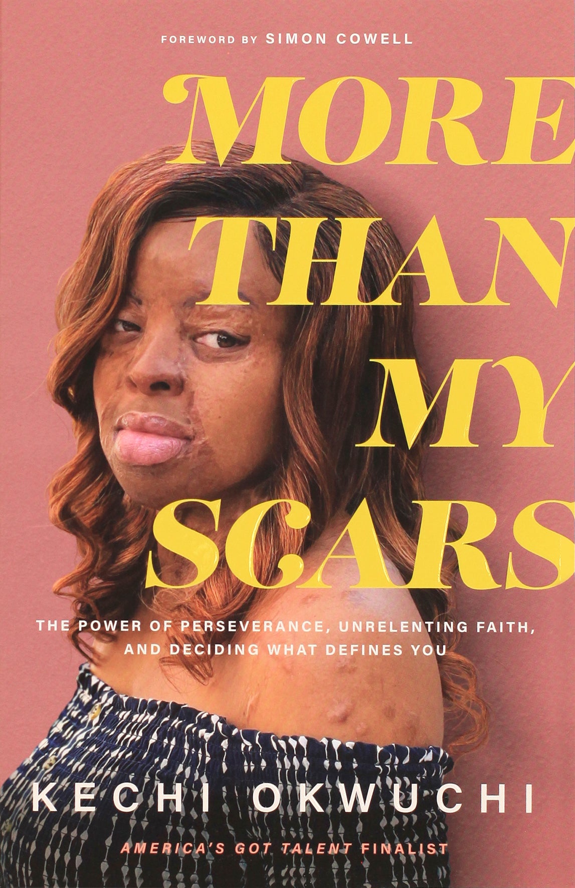 More Than My Scars: The Power of Perseverance, Unrelenting Faith, and Deciding What Defines You