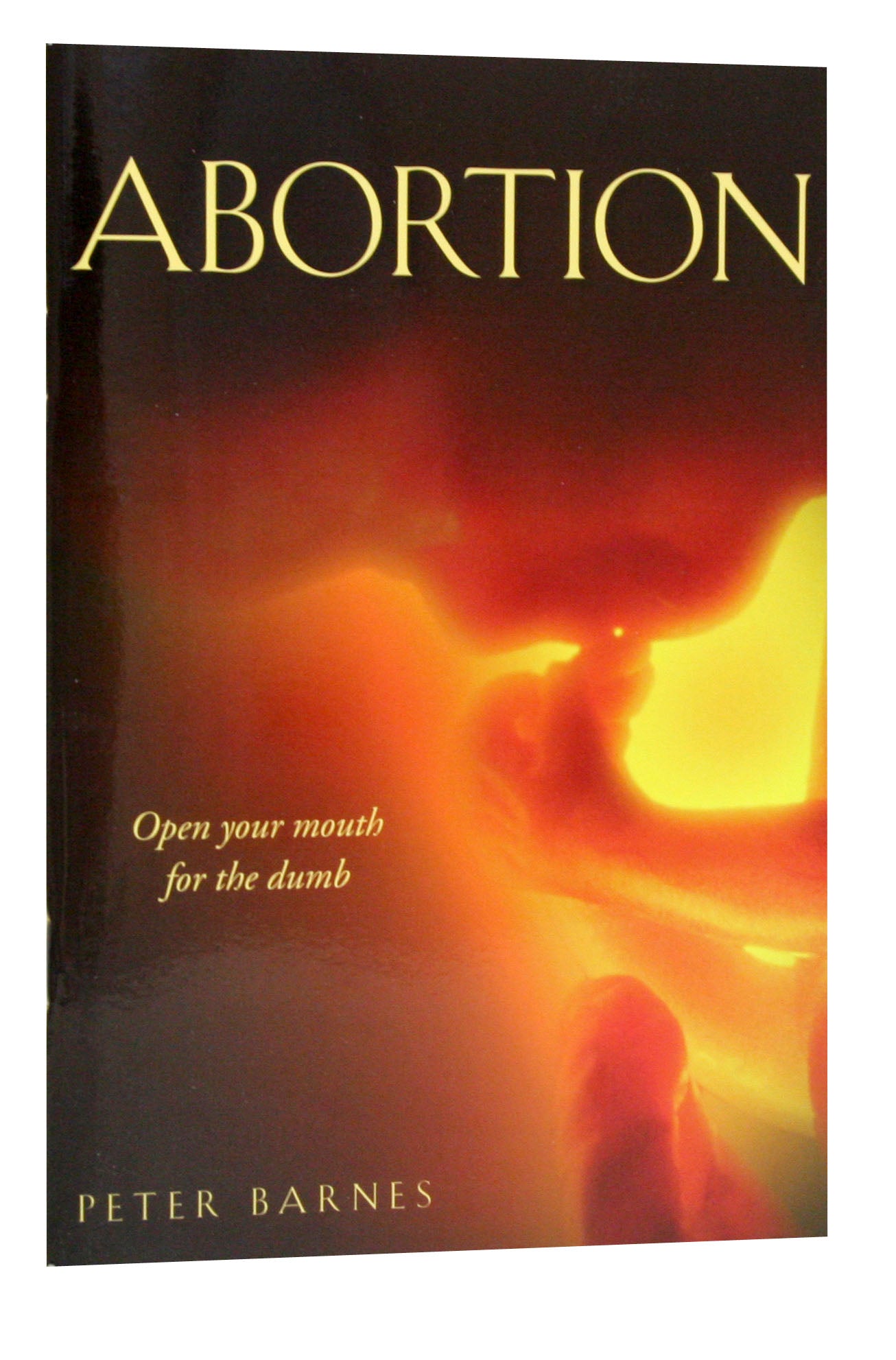 Abortion